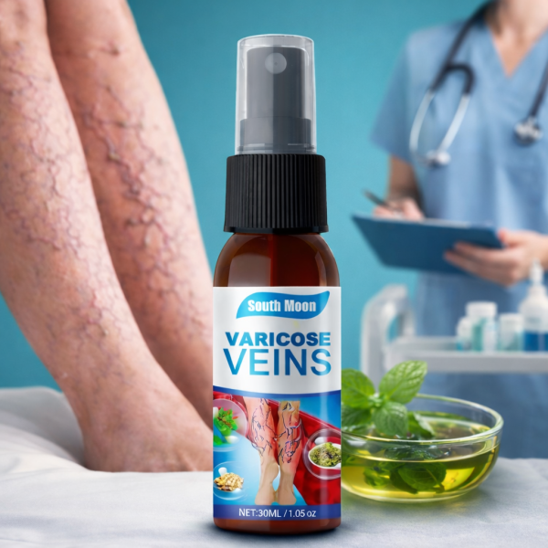 Varicose Veins