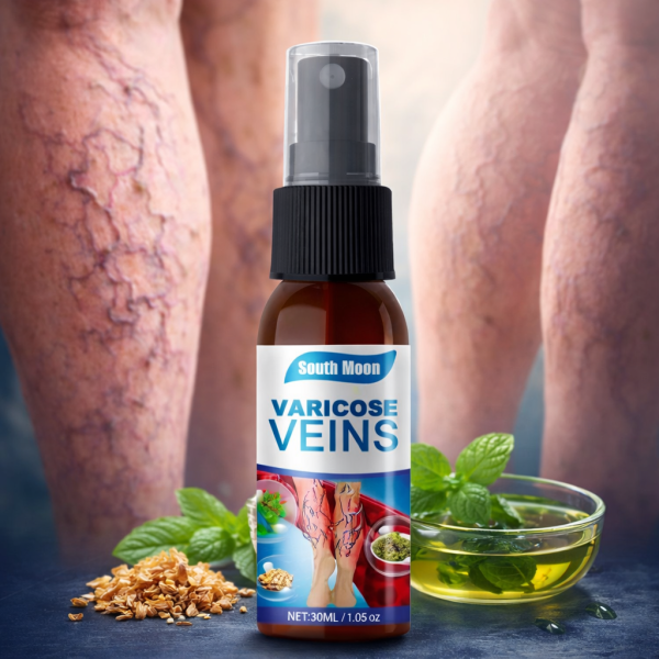 Varicose Veins